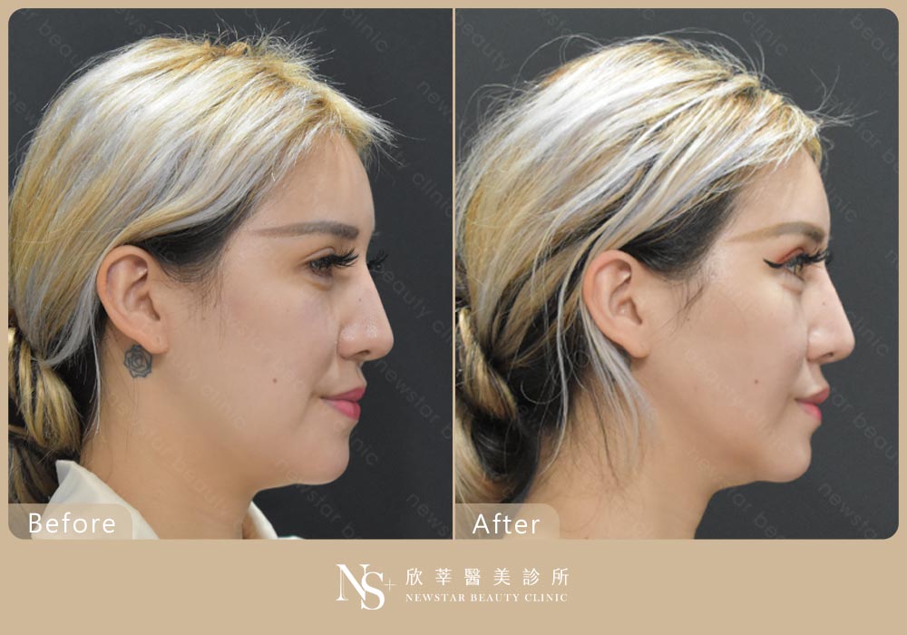 電波拉提BA_神力拉提01