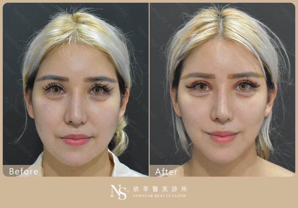 電波拉提BA_神力拉提02