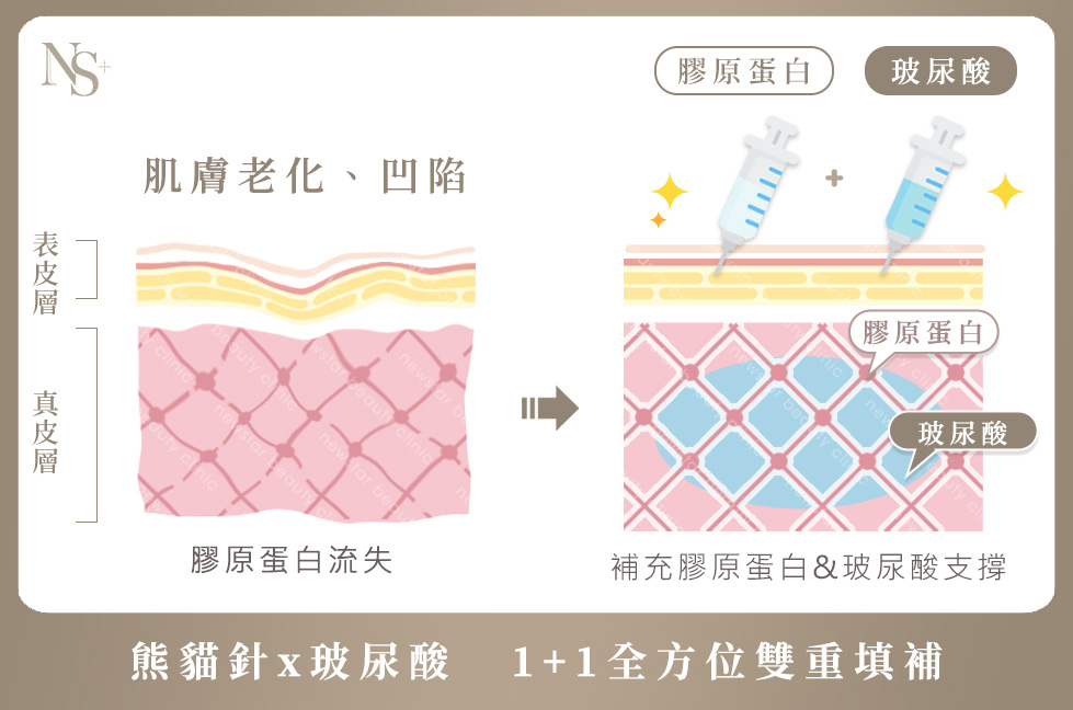 玻尿酸+膠原蛋白