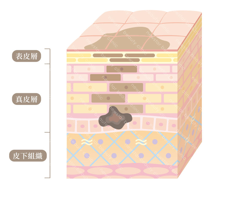 膠原蛋白熊貓針_原理圖新版01