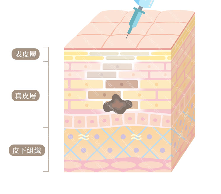 膠原蛋白熊貓針_原理圖新版02