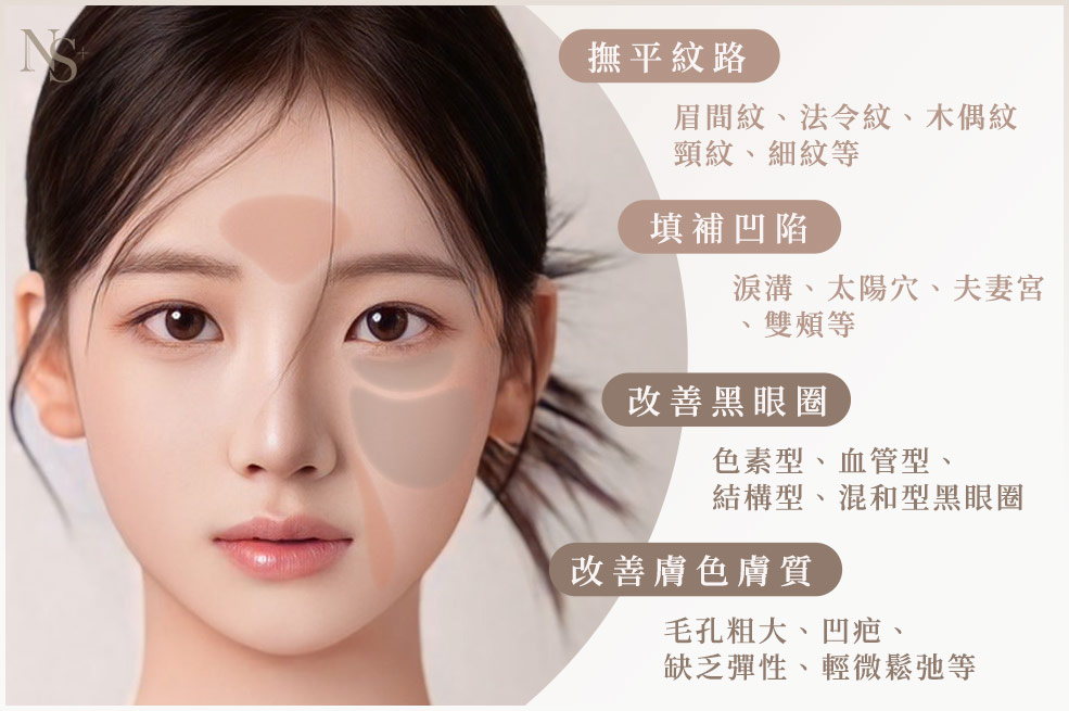 臉部施打部位(新)(咖)