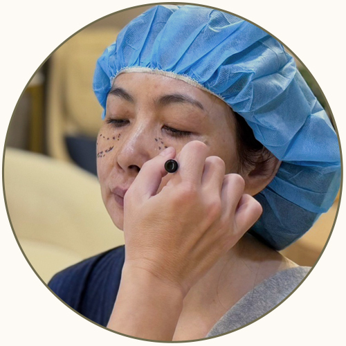 眼袋手術流程_畫線