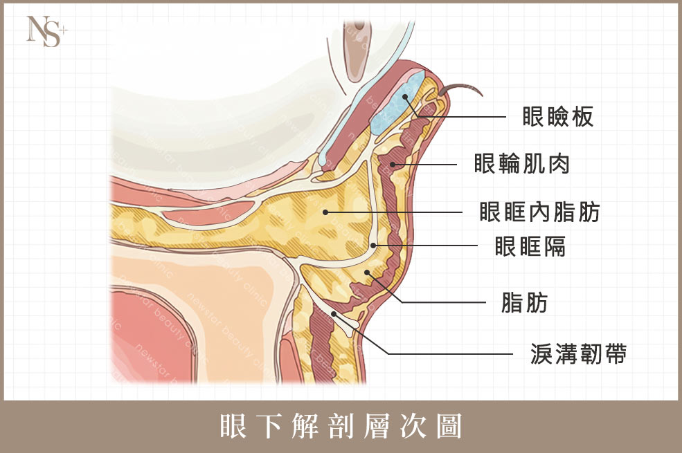 眼袋側面解剖圖