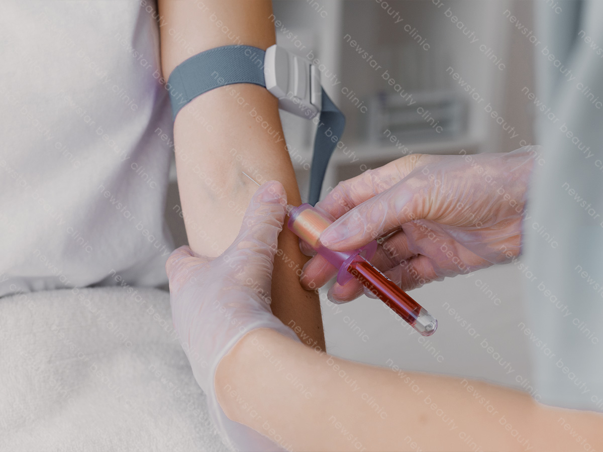 隆乳手術_術前健康檢查