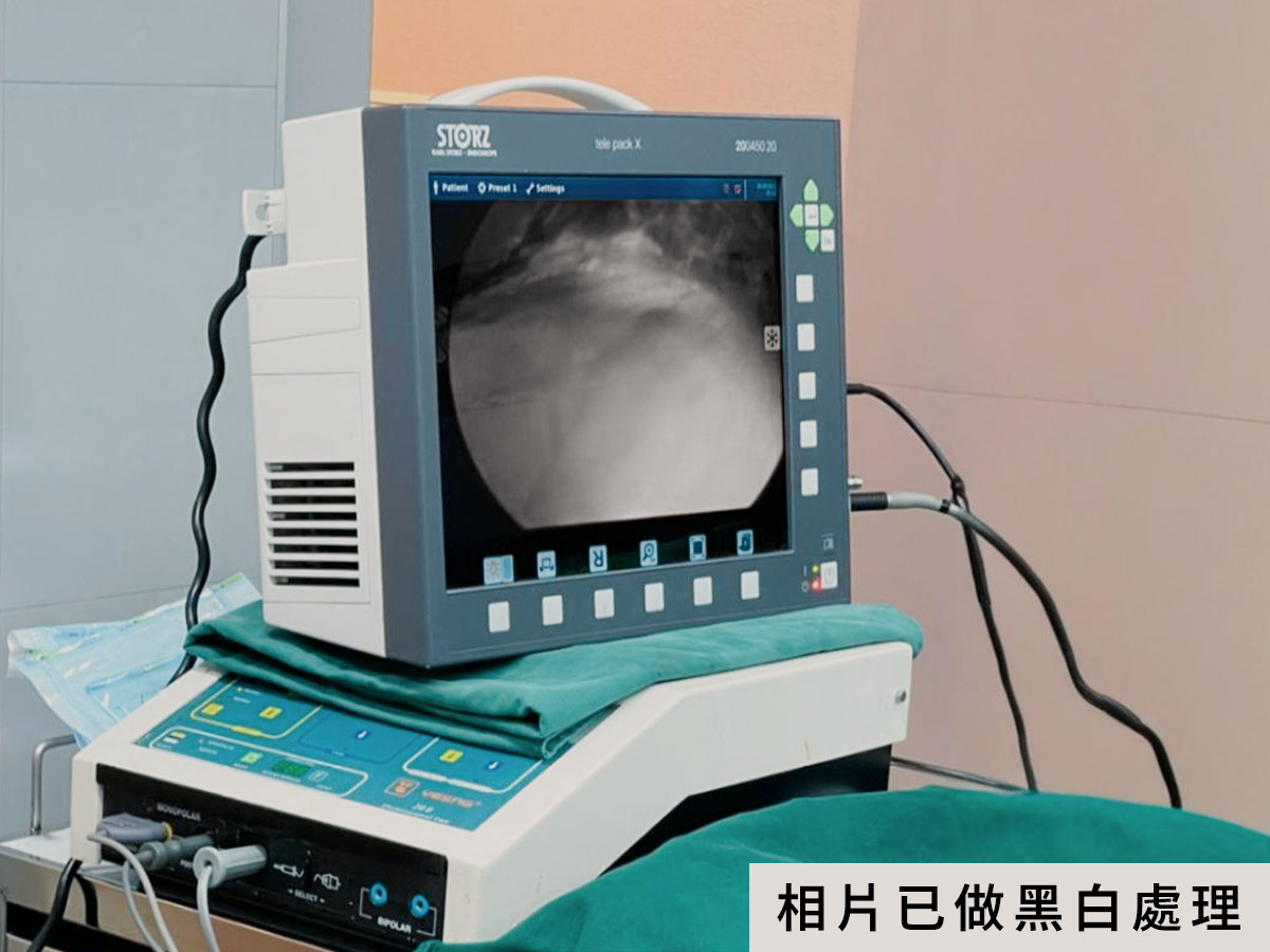 隆乳費用_高階內視鏡設備