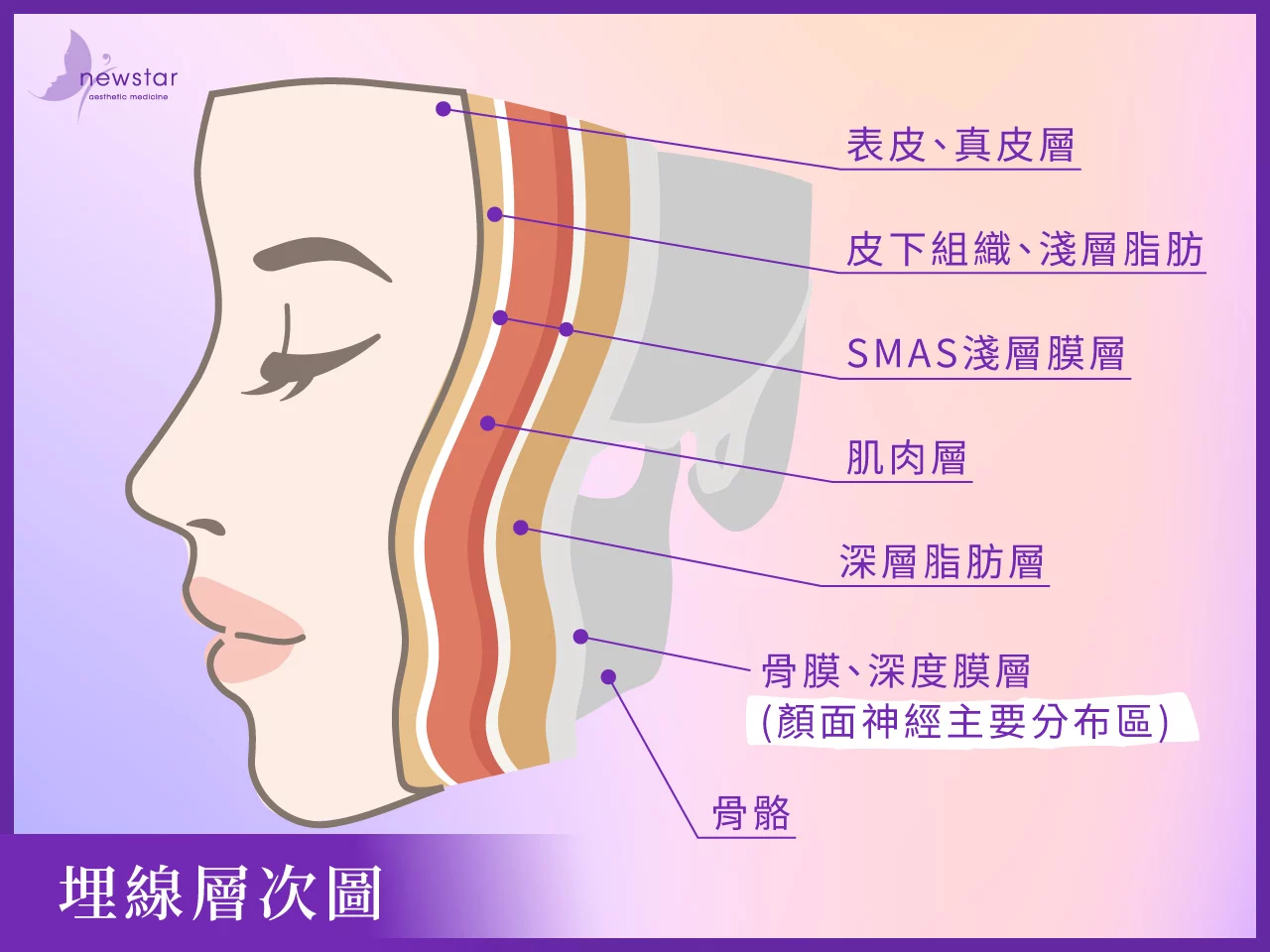 埋線拉提_埋線層次圖