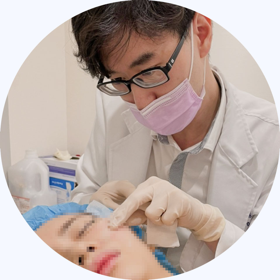 埋線拉提_療程步驟_療程操作