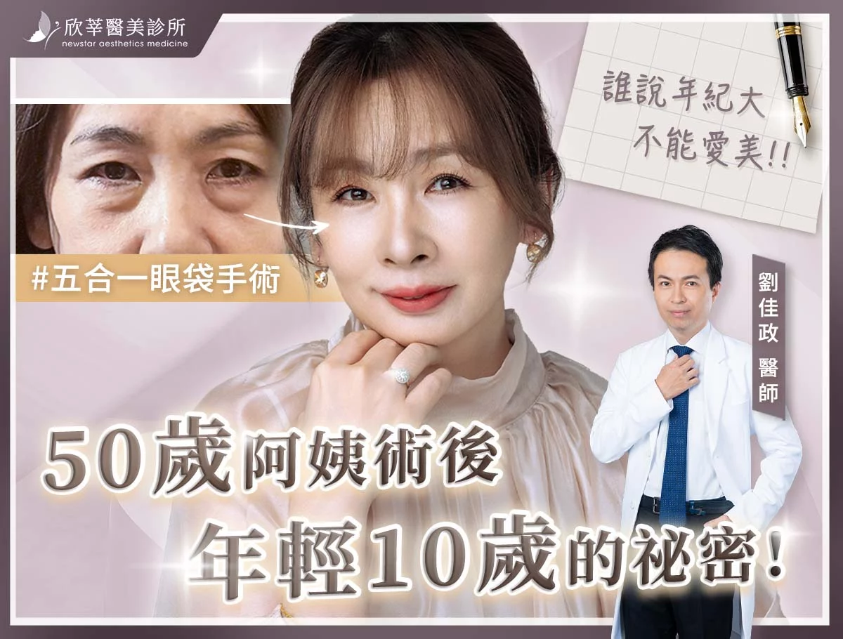 阿姨年輕10歲 外bn