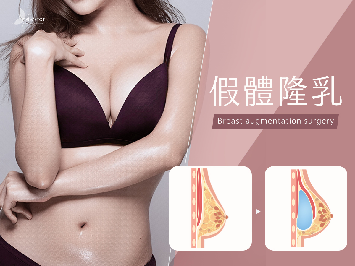 假體隆乳bn01
