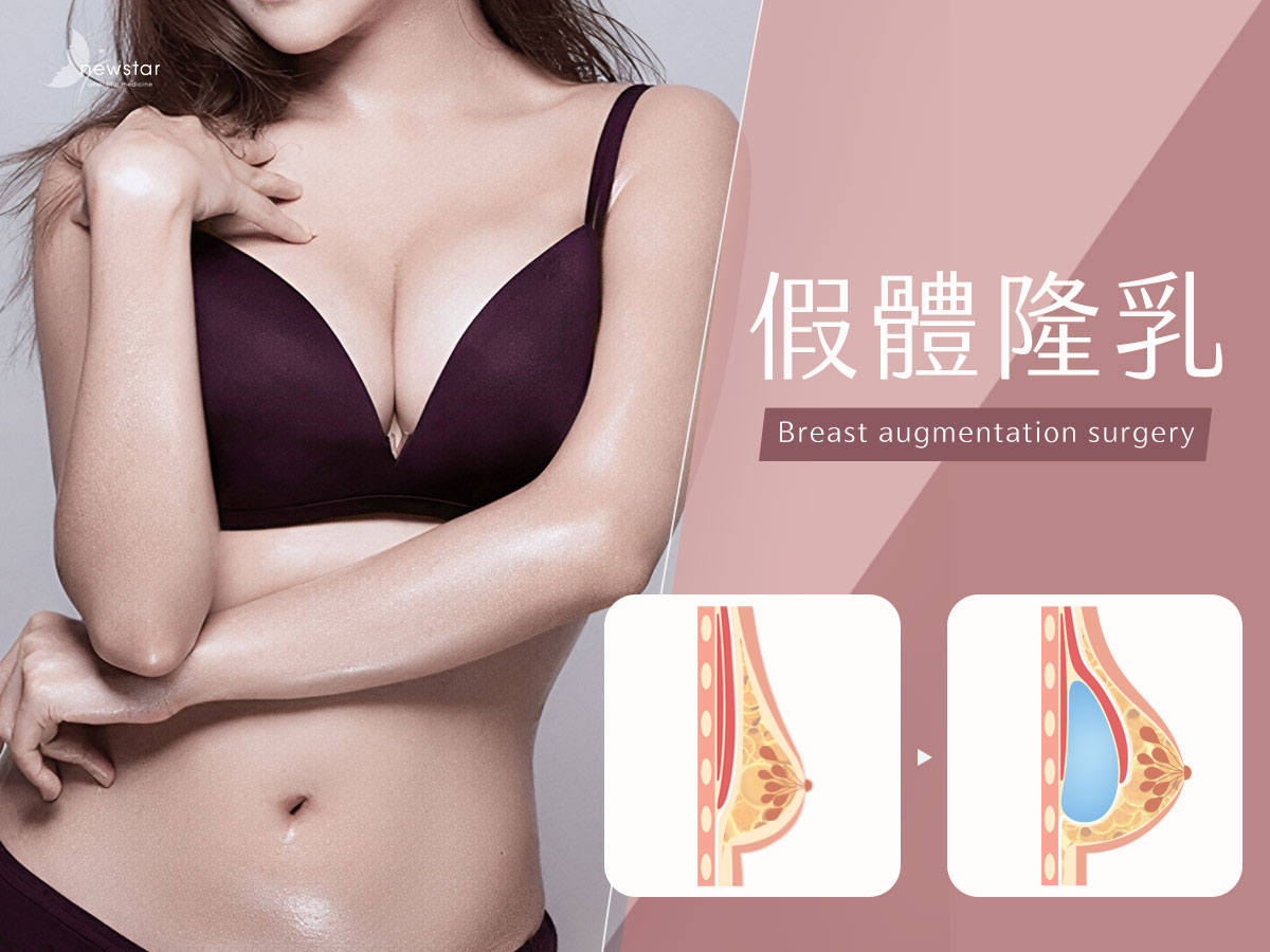 假體隆乳bn04