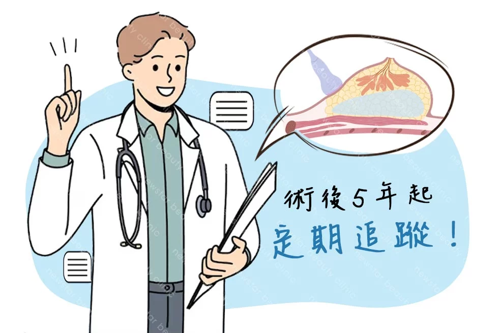 假體風險缺點 定期追蹤04