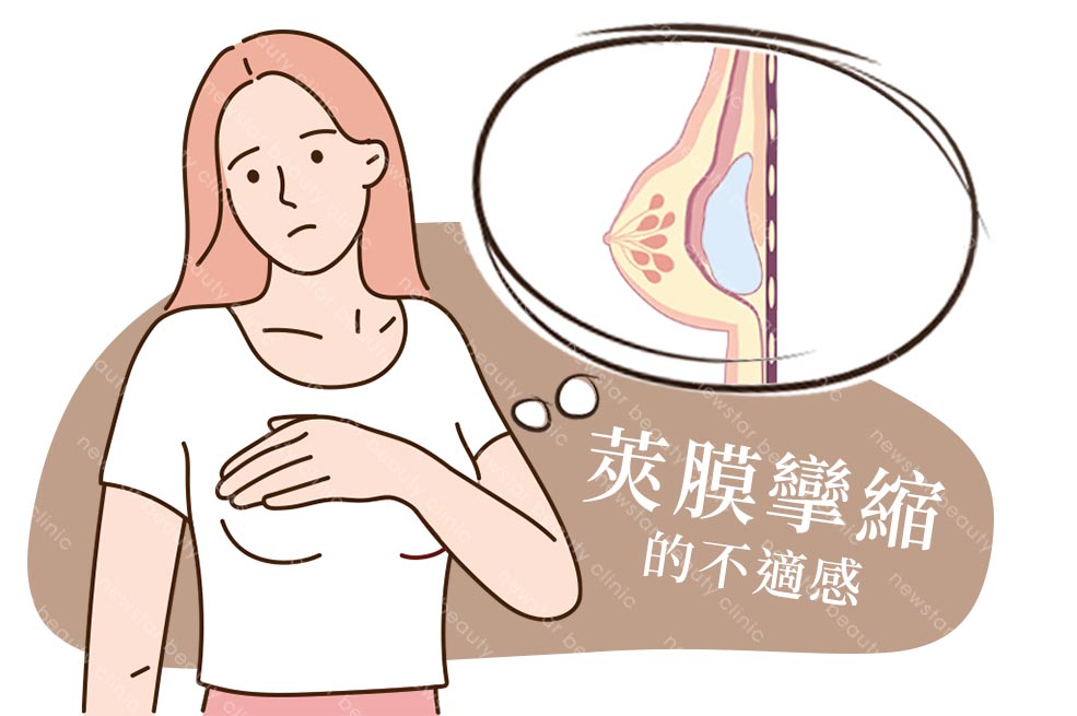 假體風險缺點_莢膜攣縮006