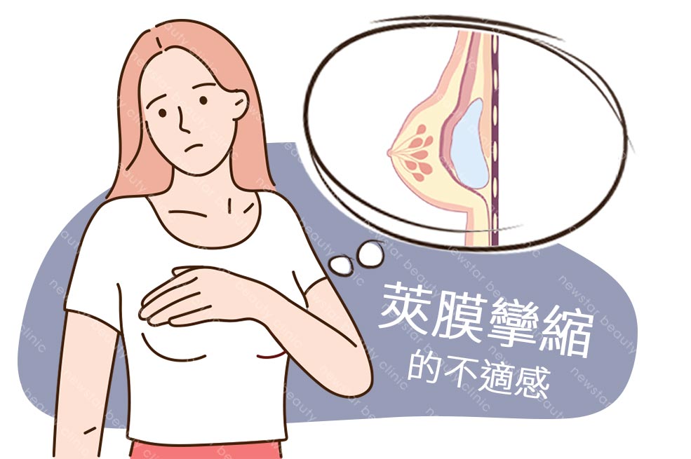 假體風險缺點_莢膜攣縮03