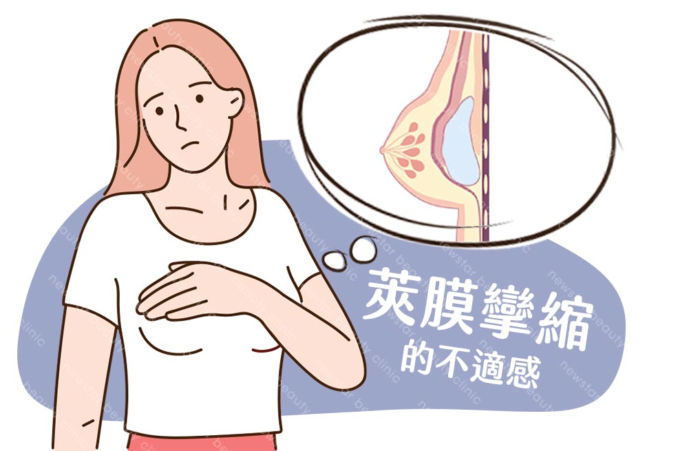假體風險缺點_莢膜攣縮05