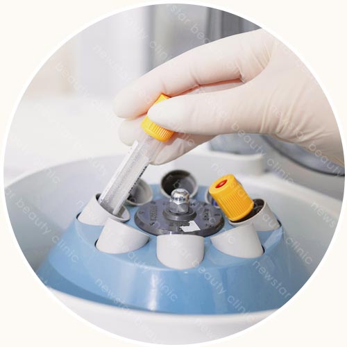 回填過程_脂肪離心