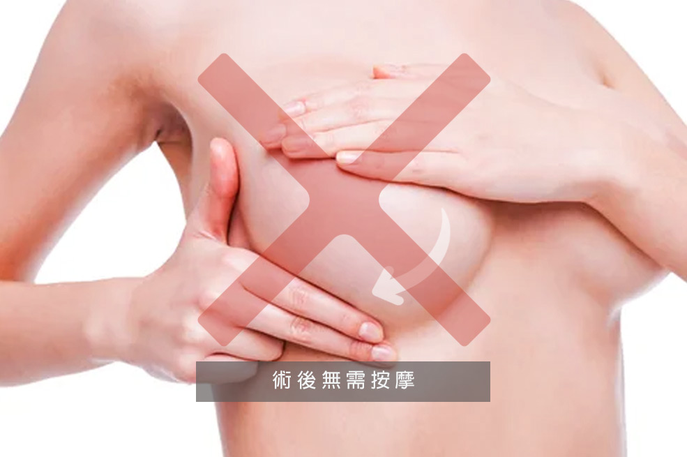 自體脂肪隆乳的優缺點_術後無須按摩01