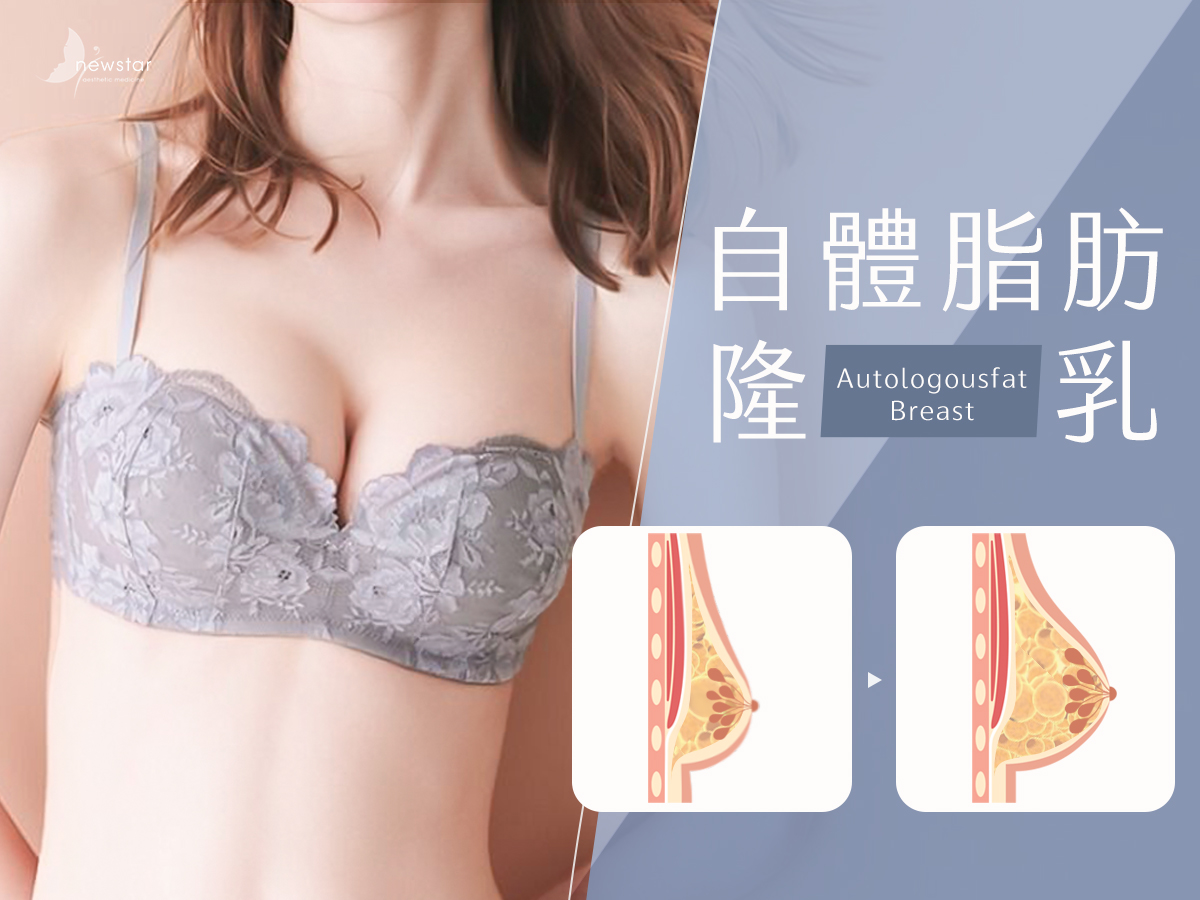 自體隆乳bn03