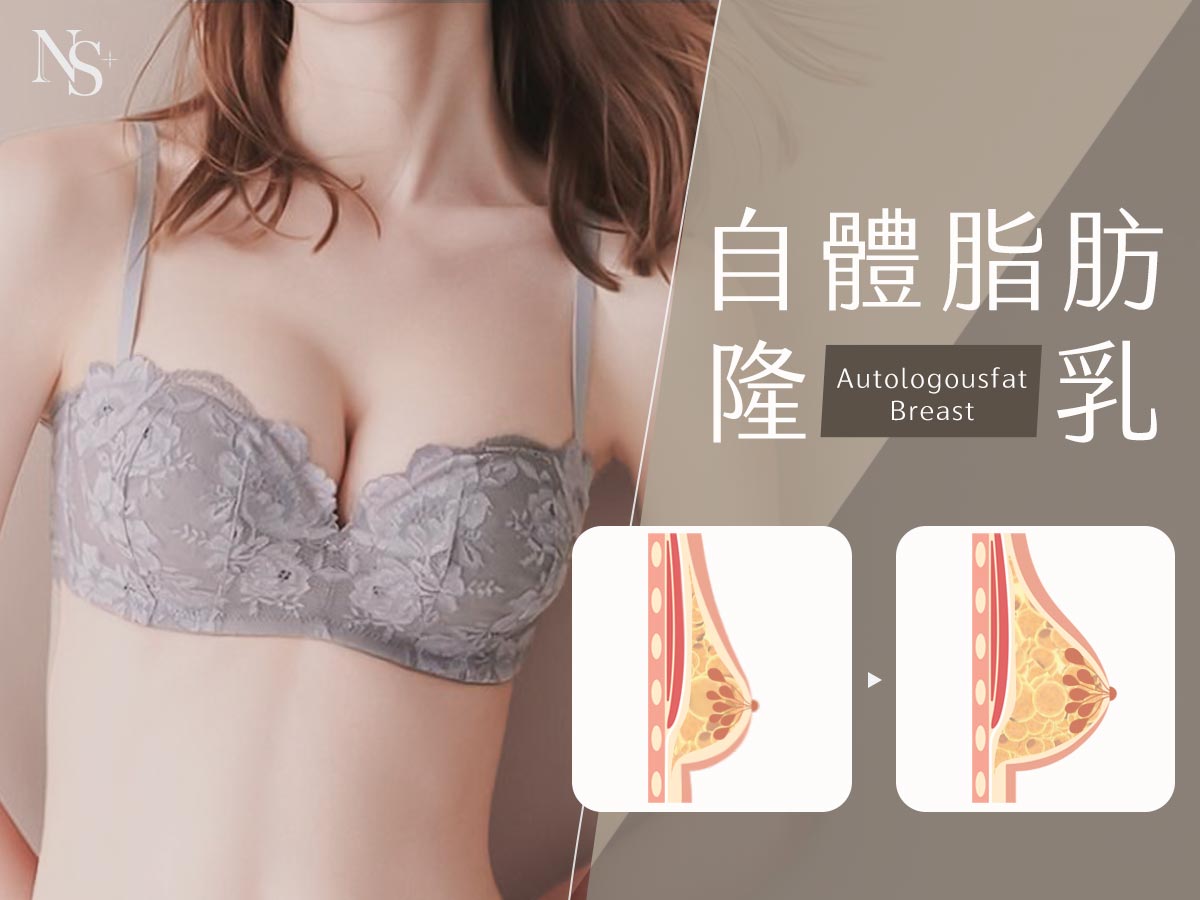 自體隆乳bn(咖啡色調)