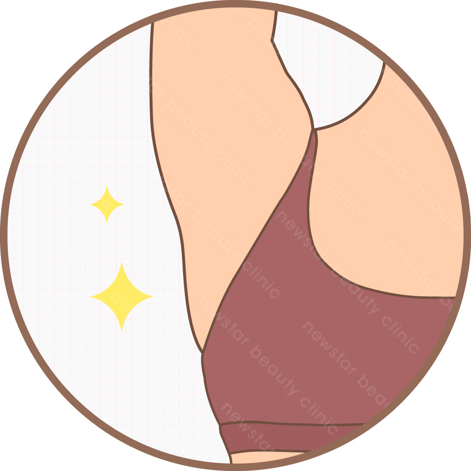 雷射除毛_術後護理