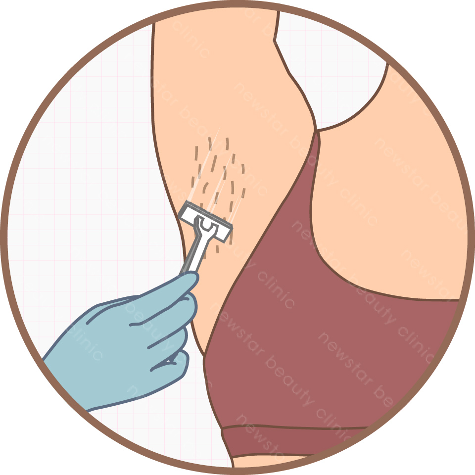 雷射除毛_醫師診斷