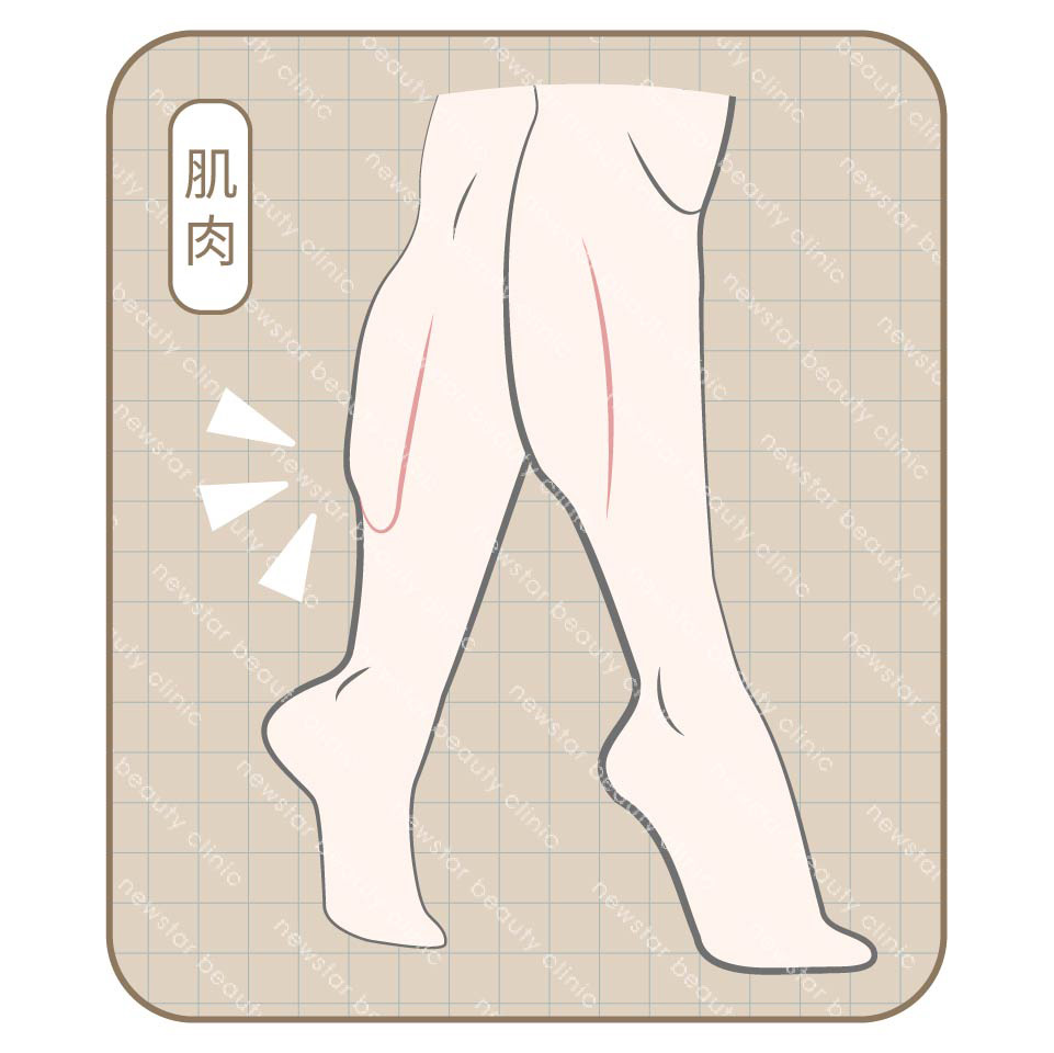 瘦小腿_肌肉型