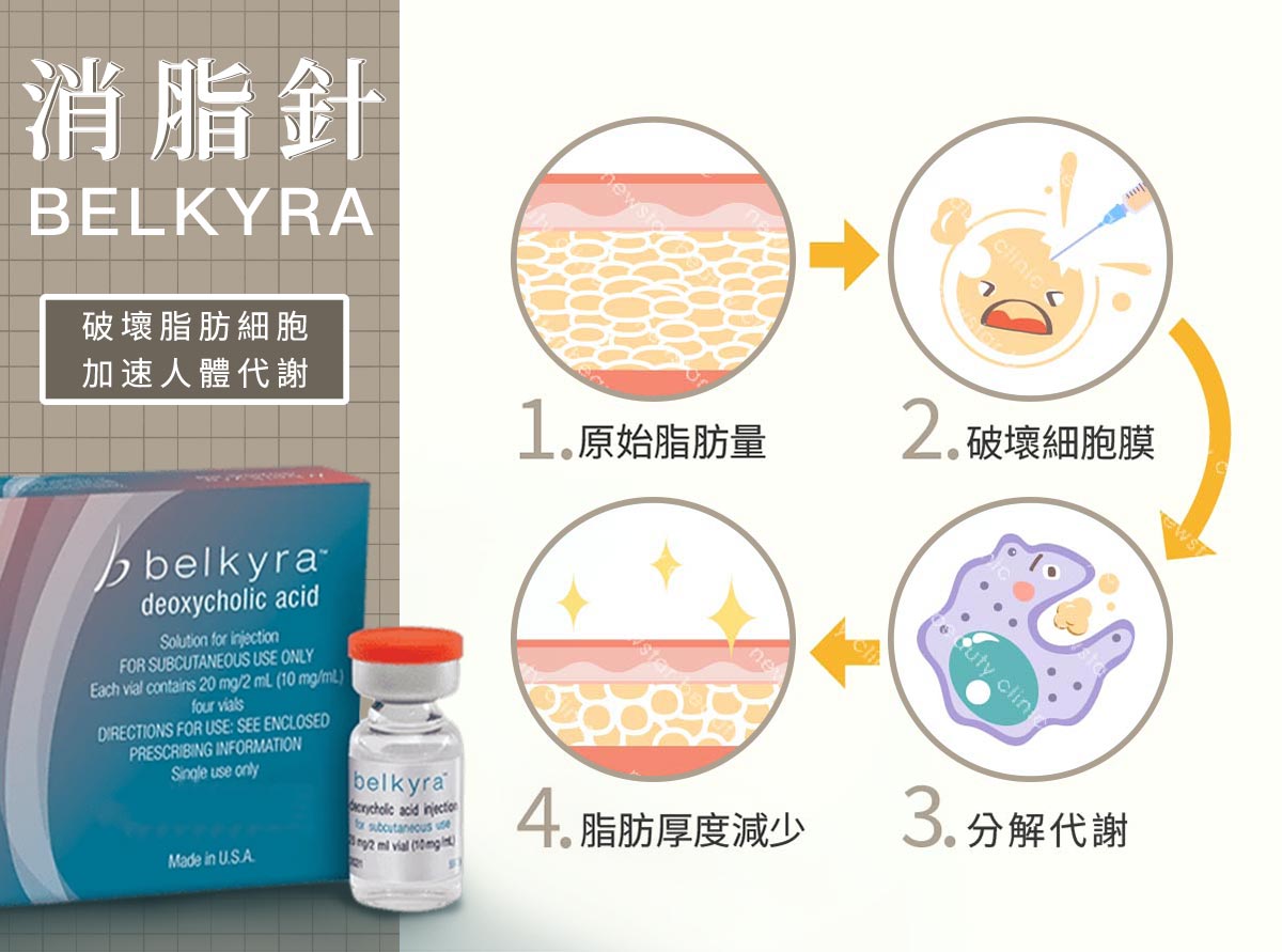 瘦小腿方式_消脂針