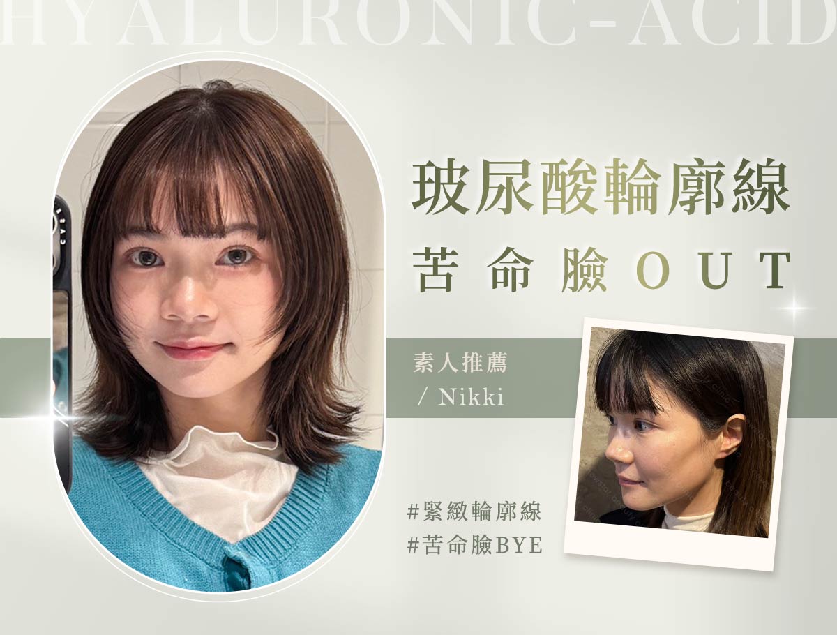 微整官網案例_外bn_輪廓固定_nikki