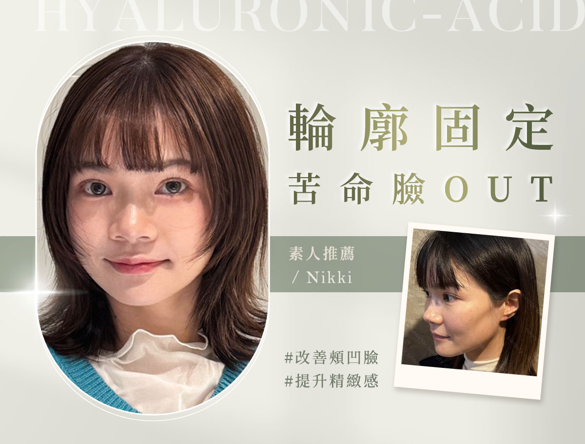 微整官網案例_外bn_輪廓固定_nikki