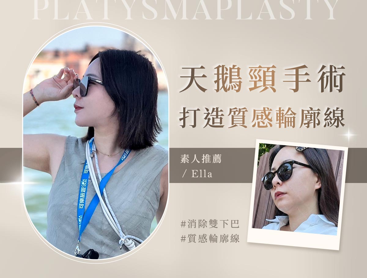 手術官網案例_天鵝頸手術_外bn_ella