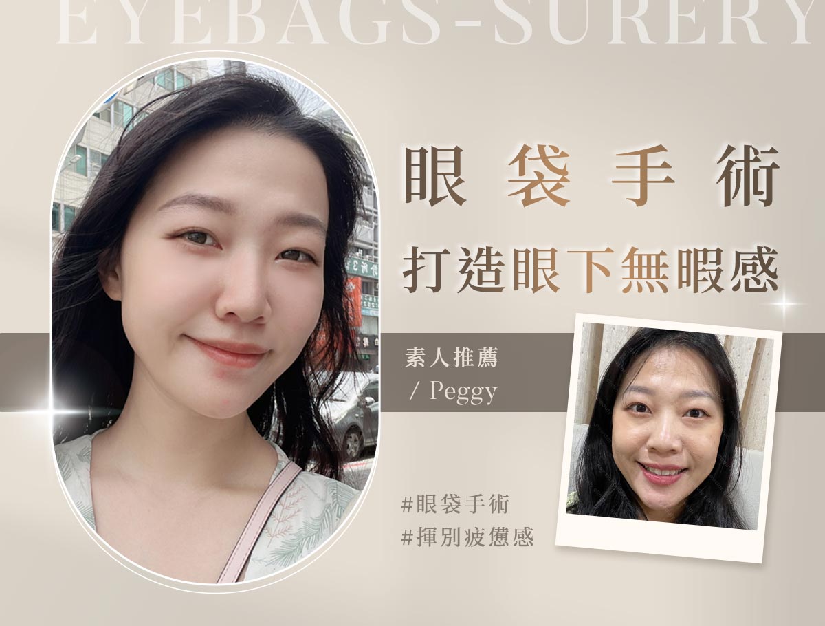 手術官網案例_外bn_peggy07