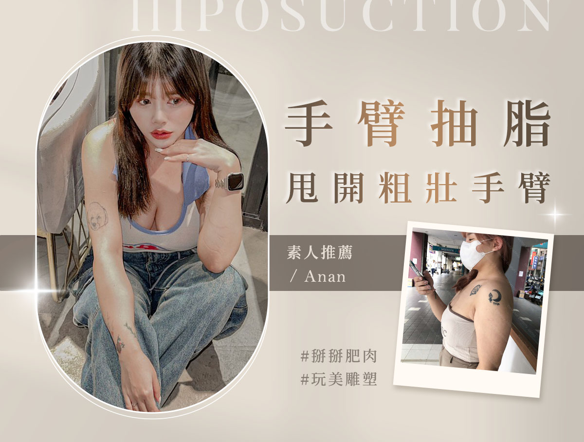 手術官網案例_外bn_安安