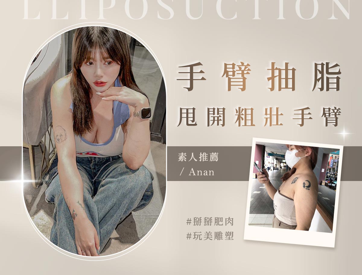手術官網案例_外bn_安安2