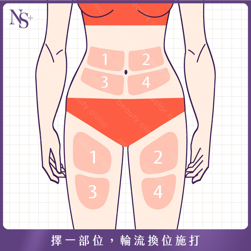 猛健樂怎麼施打_施打部位