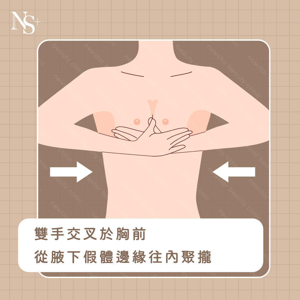 2026隆乳最新攻略！手術方式、材質費用、後遺症｜隆乳問題完整解析- 欣莘時尚美學診所