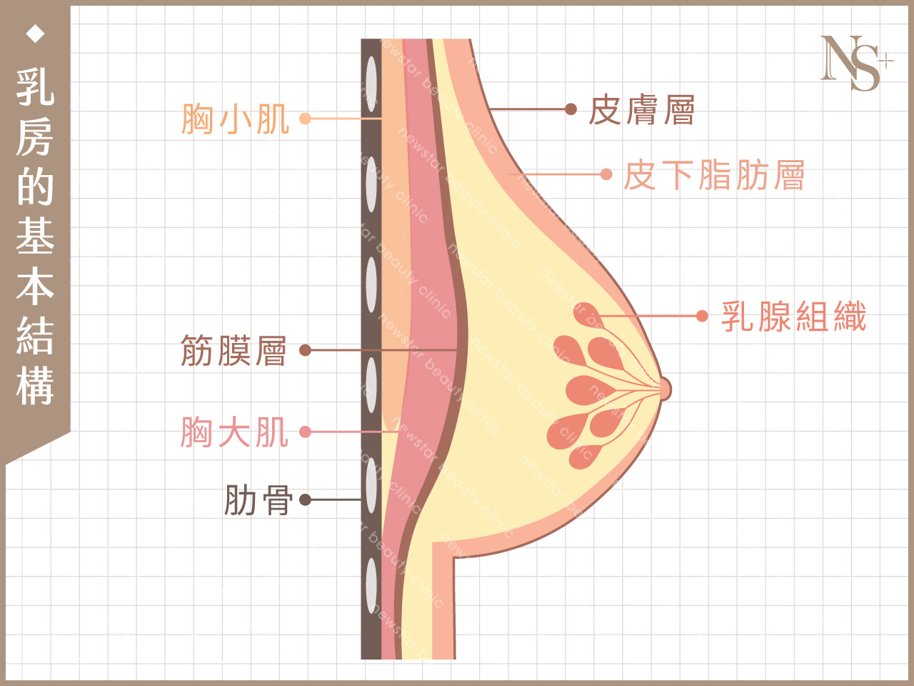 隆乳手術_假體位置_乳房結構圖