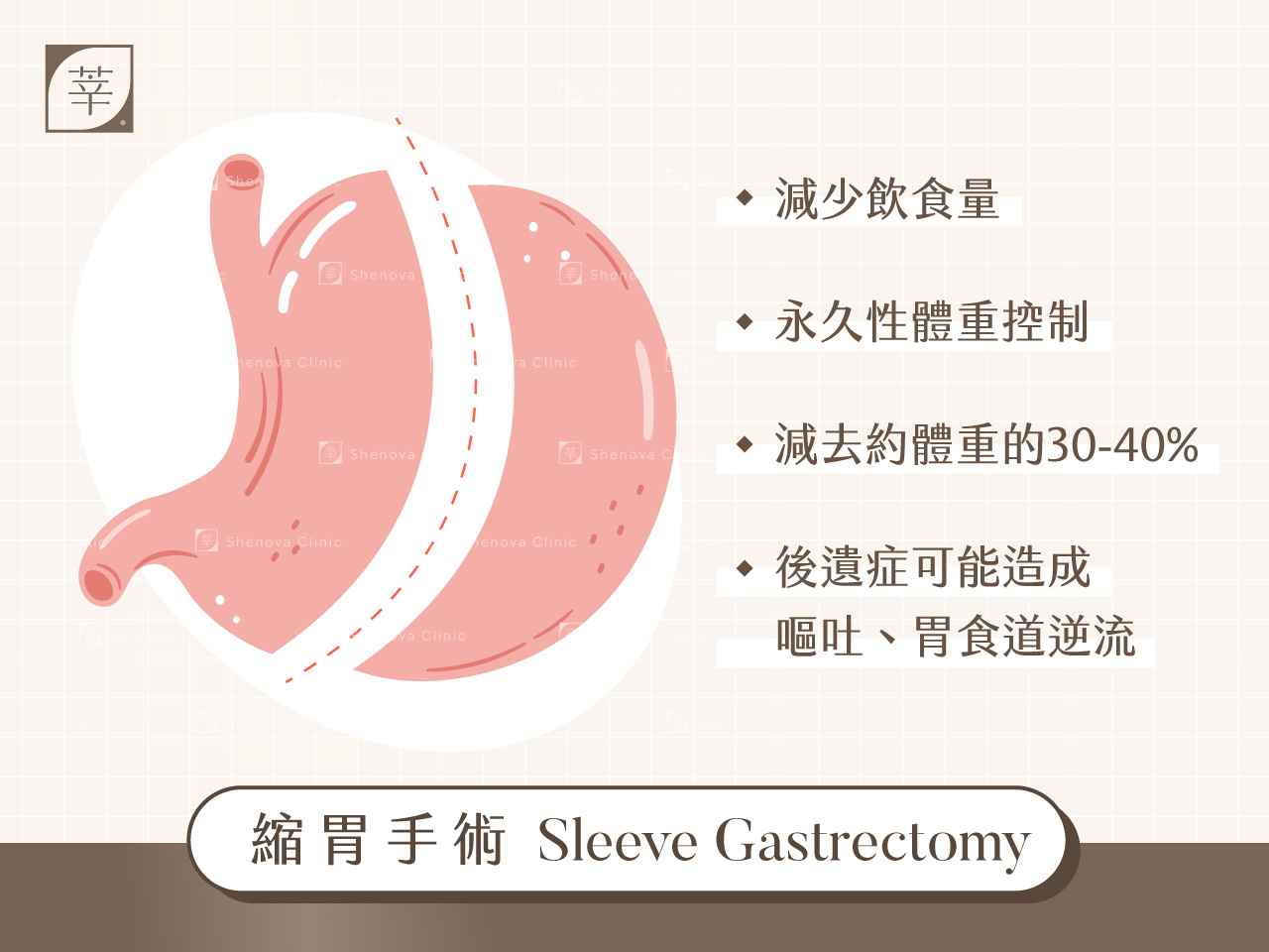 減重門診_縮胃手術