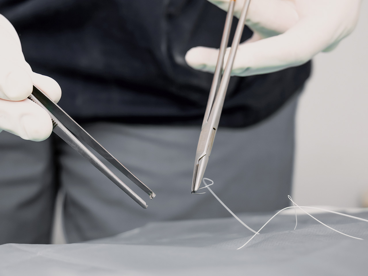 隆乳手術完整流程_術後拆線