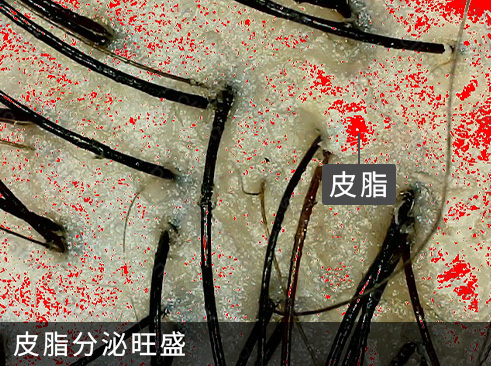 養育髮治療_案例