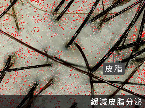 養育髮治療_案例