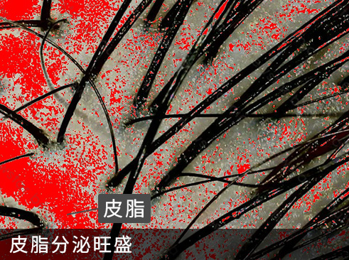 養育髮治療_案例