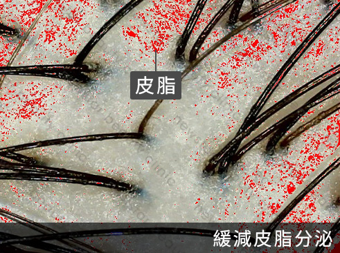 養育髮治療_案例