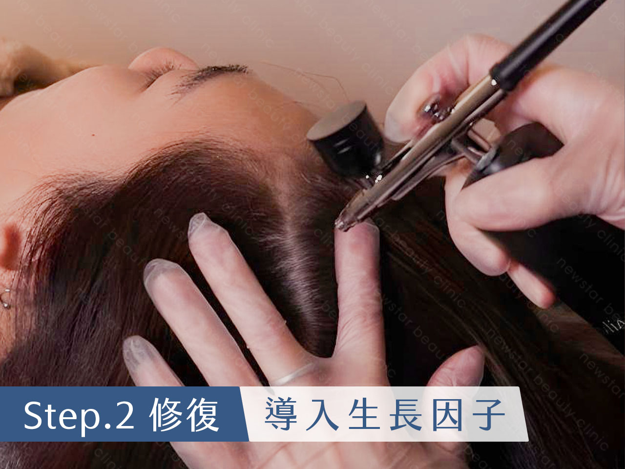 養育髮治療_Scalp Rebirth_修護