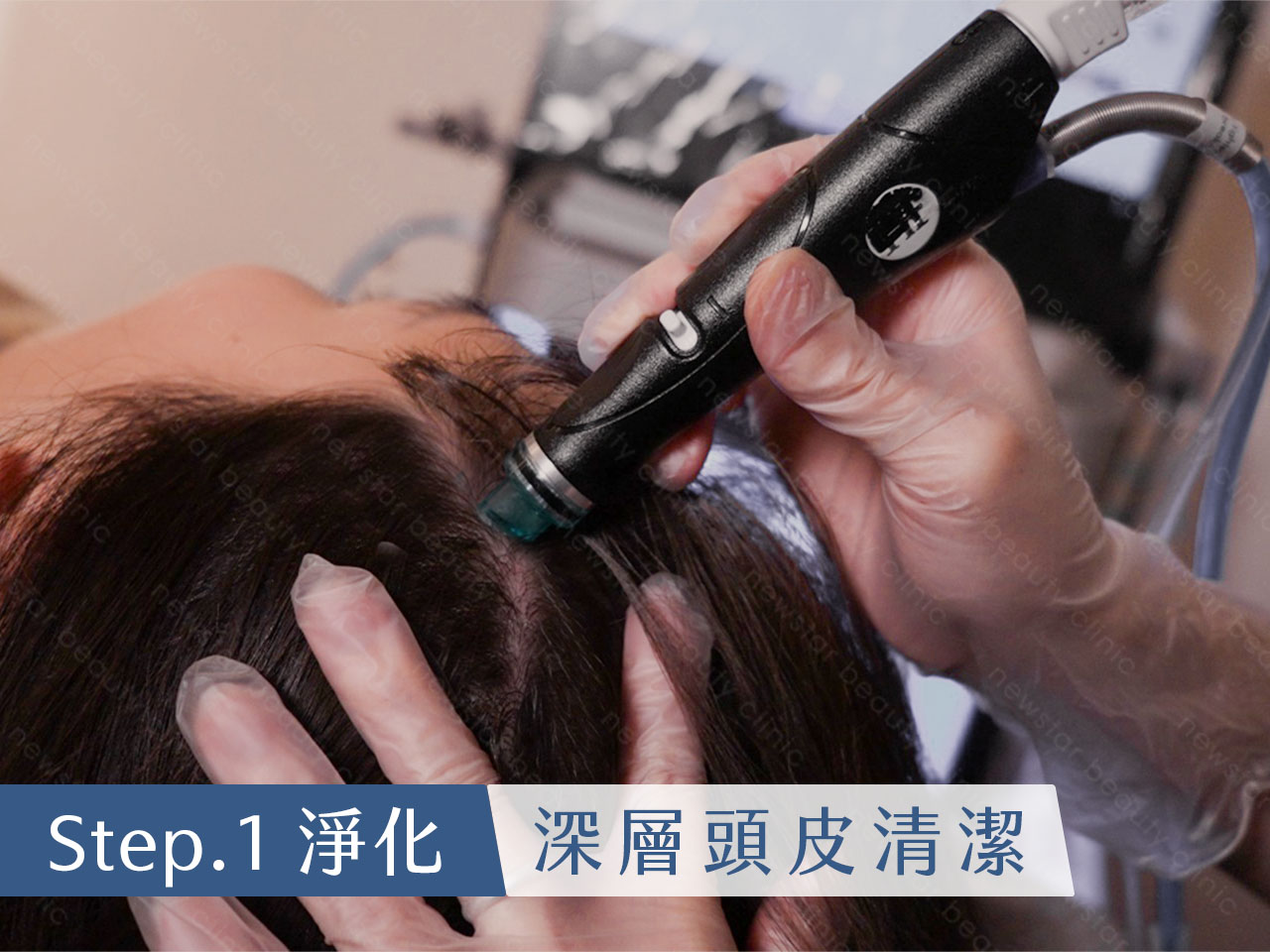 養育髮治療_Scalp Rebirth_海菲秀