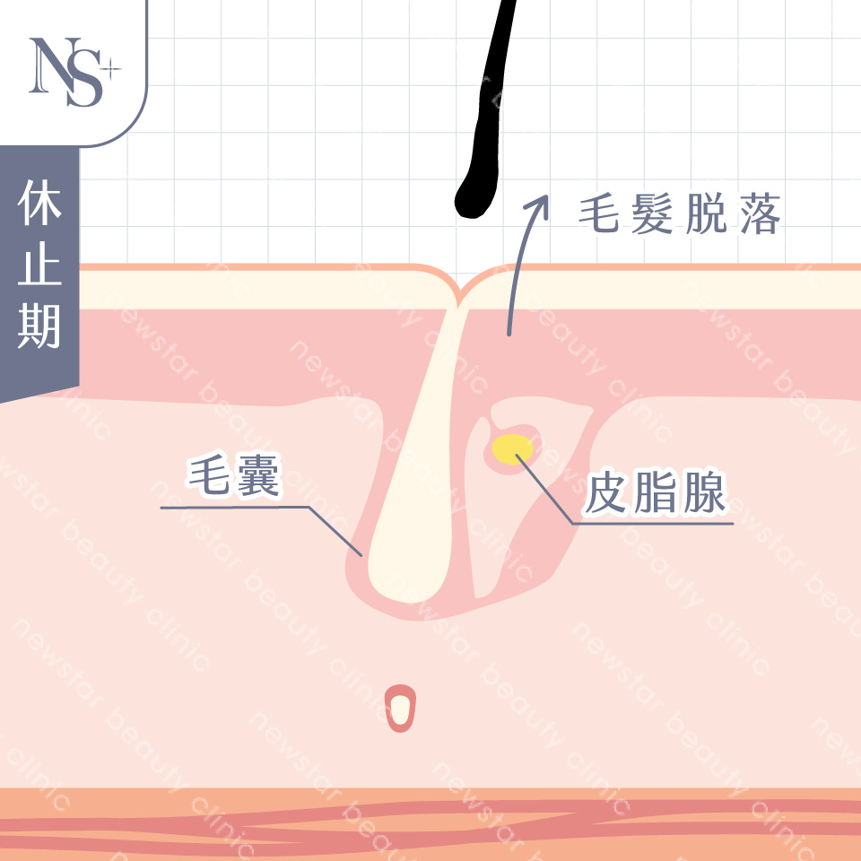 養育髮治療_休止期