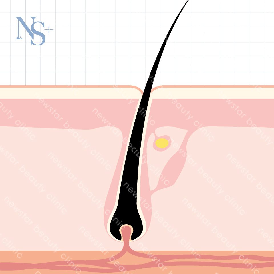 養育髮治療_生長期