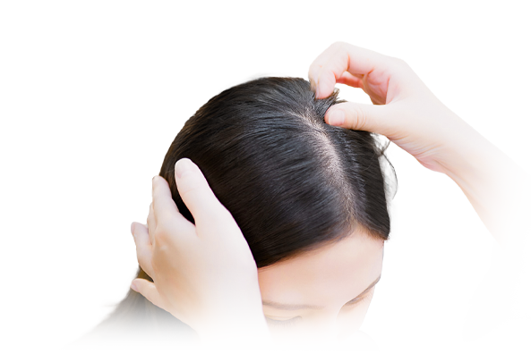 養育髮治療_置頂圖