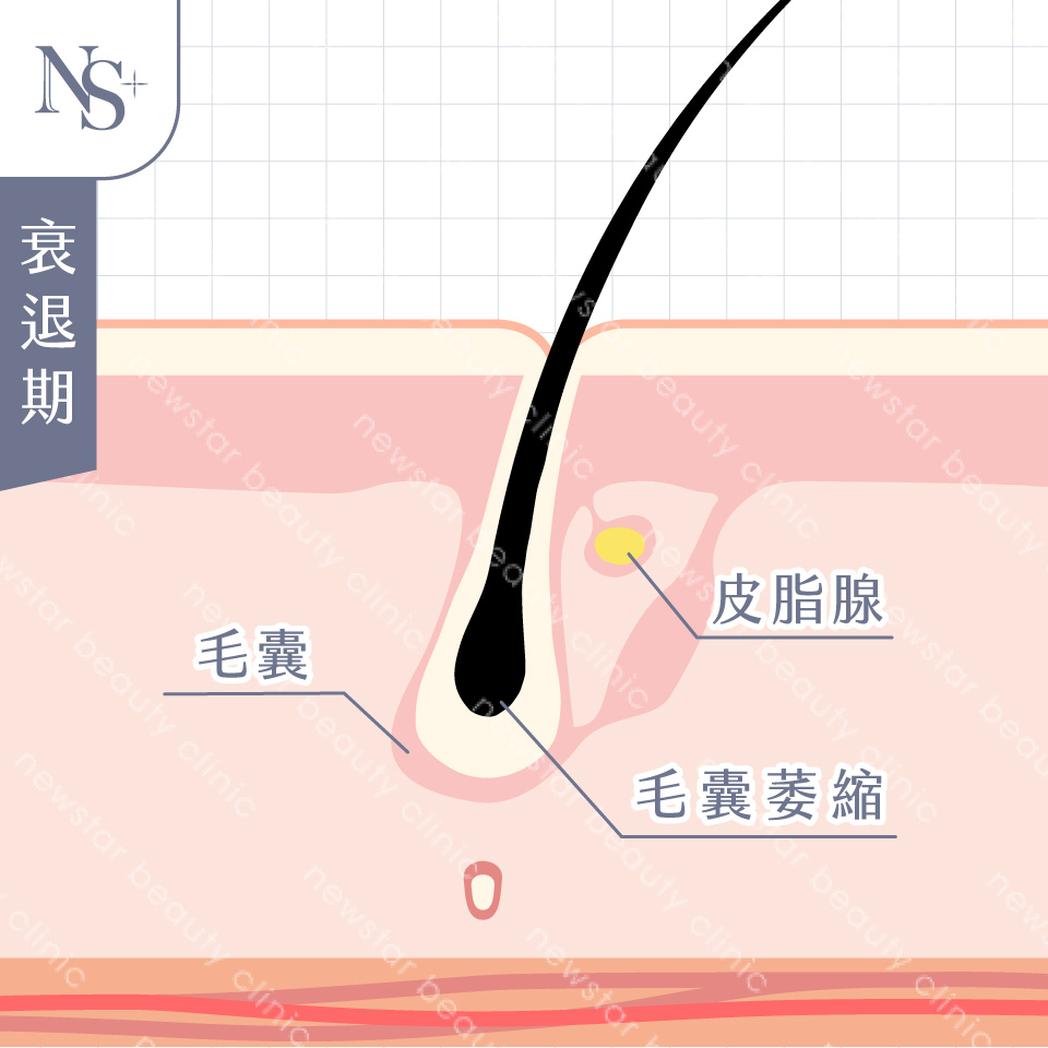 養育髮治療_衰退期