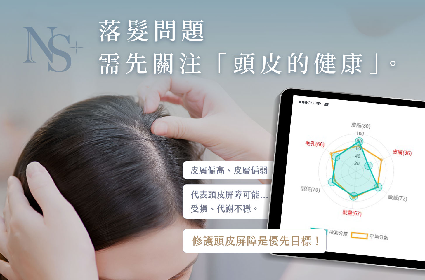 養育髮治療_養好頭皮