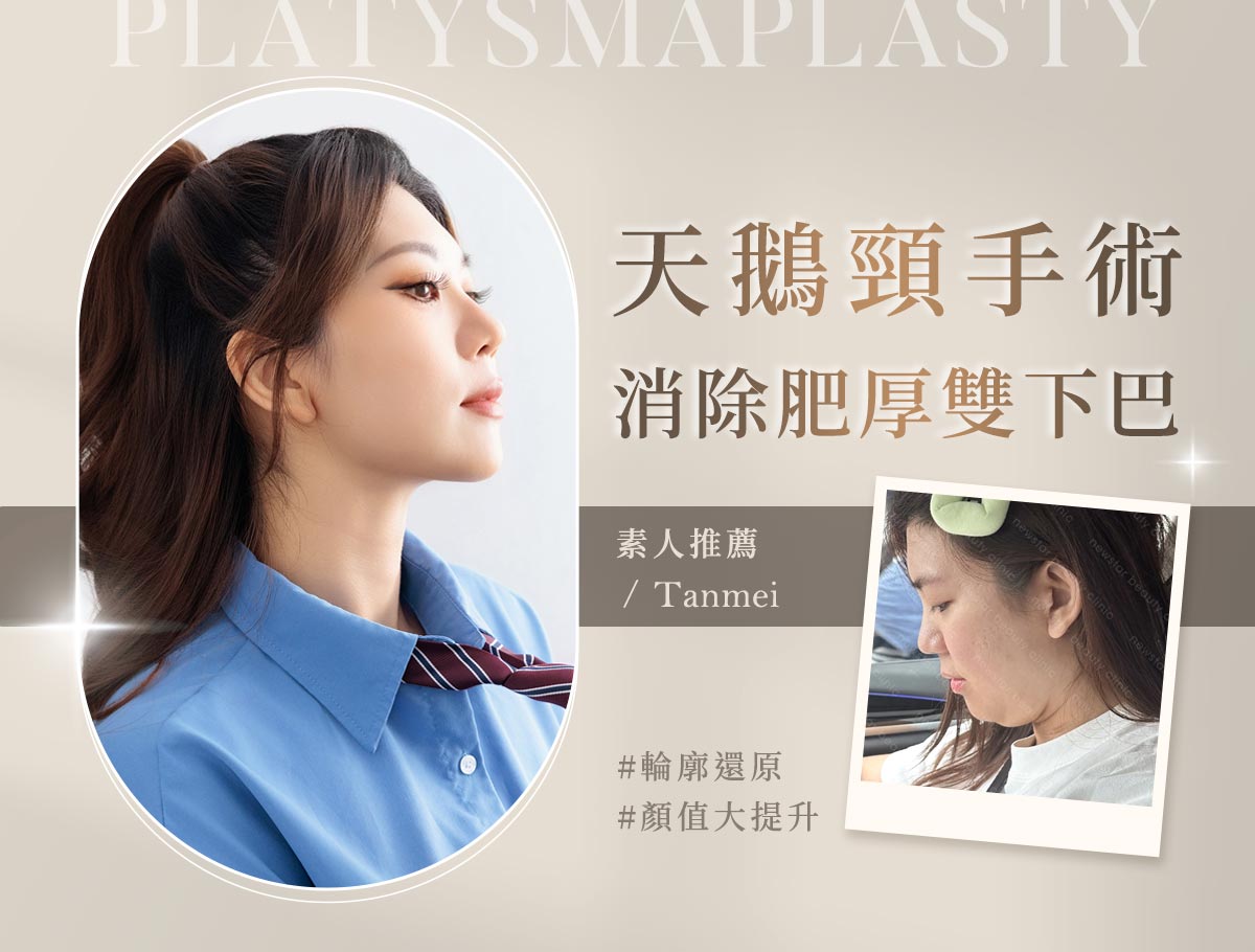天鵝頸手術官網案例_外bn_kol潭美